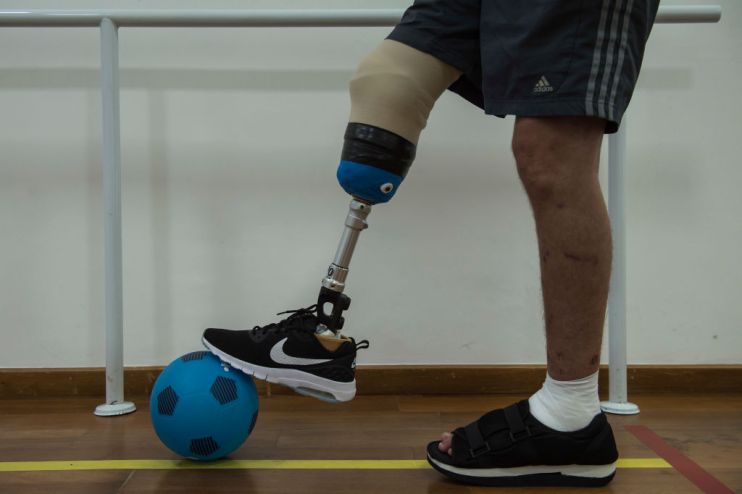 TOPSHOT-FBL-BRAZIL-CHAPECOENSE-SURVIVOR-REHABILITATION