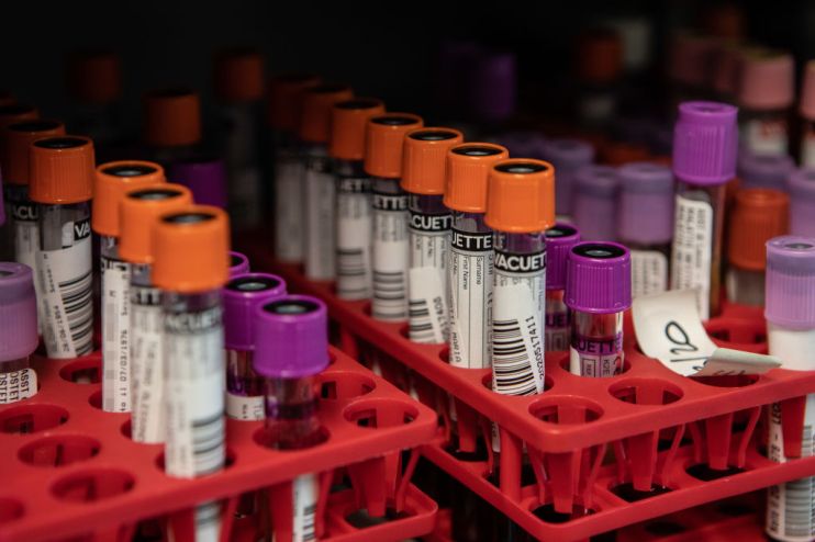 Swabs Are Tested For Coronavirus At Milan Laboratory