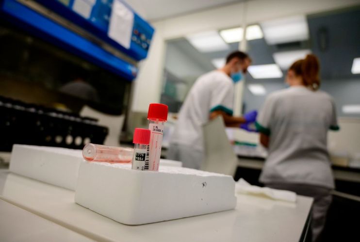A common steroid has been labelled a "major breakthrough" in the fight against coronavirus by researchers