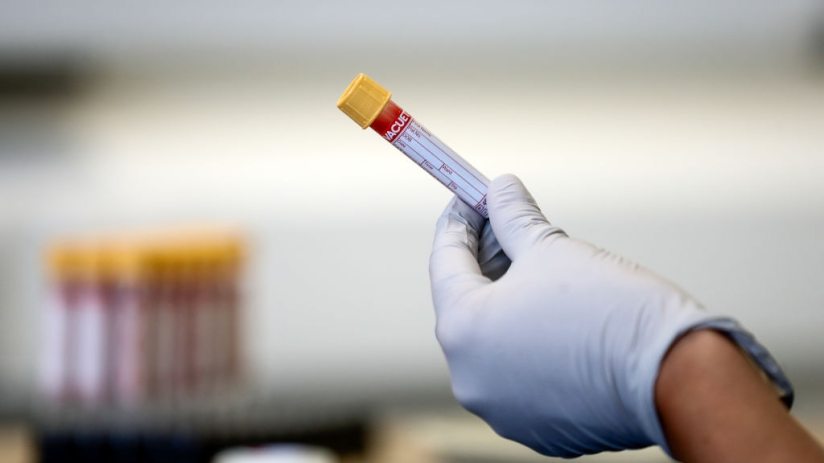 Despite reporting a challenging year, shares in the AIM-listed Fusion Antibodies sprung up 7.5 per cent at market open on Thursday.