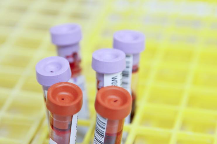 A plant-based diet may be linked to improved sexual health in men treated for prostate cancer, new research suggests.