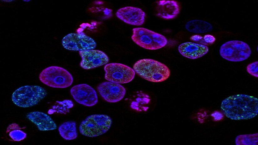 Under the agreement, ANGLE will develop a novel technology for cancer detection using DNA damage response (DDR) tests.&nbsp;
