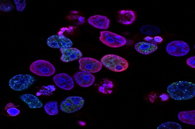 Under the agreement, ANGLE will develop a novel technology for cancer detection using DNA damage response (DDR) tests.&nbsp;