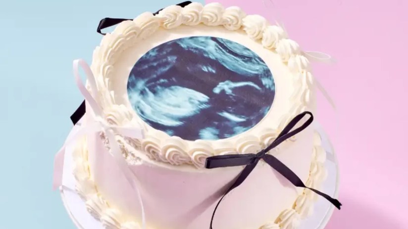 Ultrasound cake from Cake Box bakery, contributing to record sales growth in UK market, displayed on a countertop