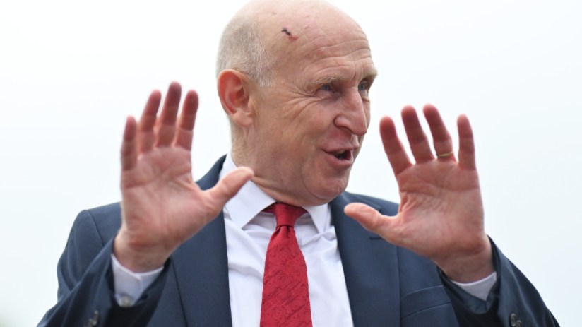 Bald man in suit and red tie gesturing with open hands, small scab visible on his forehead